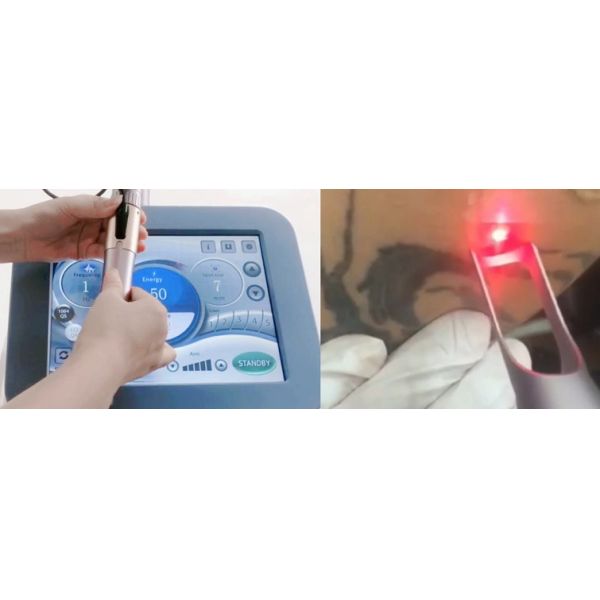 Máquina de eliminación de tatuajes sin dolor Q Switch Máquina de eliminación de tatuajes profesional 532nm