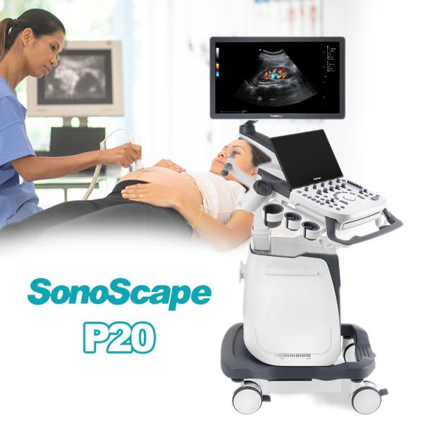Sonoscape Portable Color Doppler Ultrasound Sonoscape S22 Ultrasound Machine Sonoscape P20 Doppler Ultrasound
