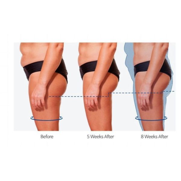 300µS тело кавитации клиники 220v EMT уменьшая машину