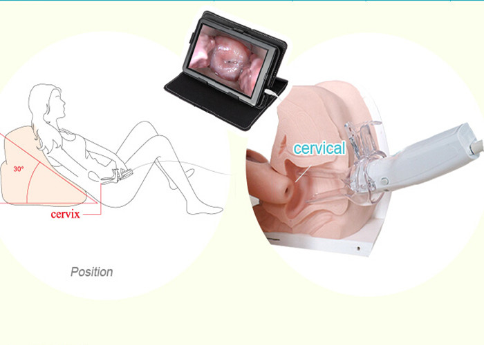 Прибор высокого Colposcope цифров дисплея определения электронного портативный для того чтобы проверить Cervix и Vagin