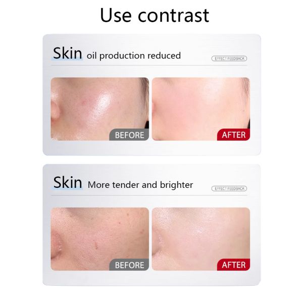 Fruit Natural Vitamin C Face Beauty Masks Skin Care Sheet Facial Skin Care Mask Face Sheet Mask