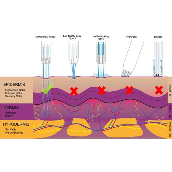 Тройной двигатель оружия брызг слезает чувство глубины проникания машины 0.3-2mm удобное