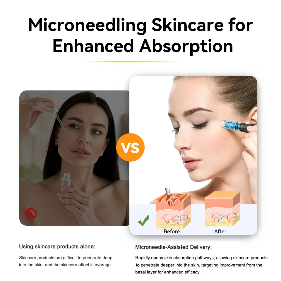 Microneedling Derma Pen Wireless Electric Microneedle Device For Improving Skin Firmness Radiance And Promoting Nutrient Absorption