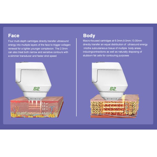 Hifu 7d Ultramax Smas смотрит на поднимаясь патроны машины 20000 съемок
