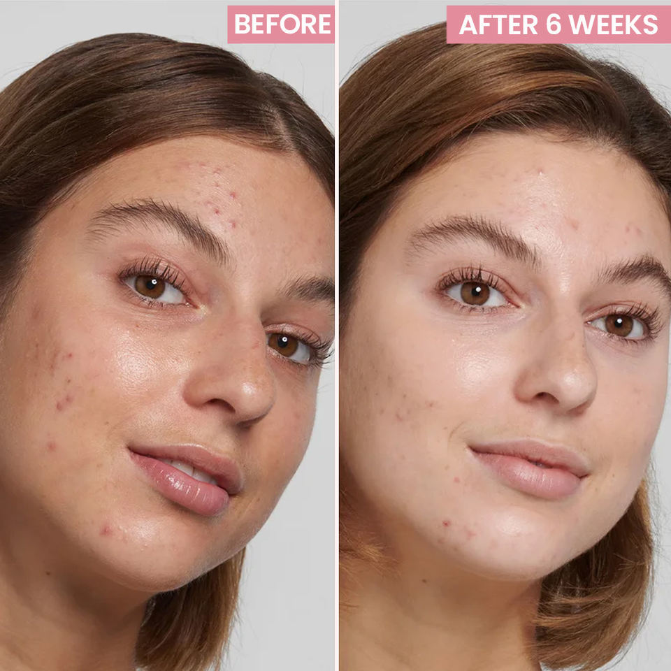 OEM ODM brand organic skin care face cream beauty product anti-aging facial moisturizing cream collagen wrinkle removing and brightening face cream