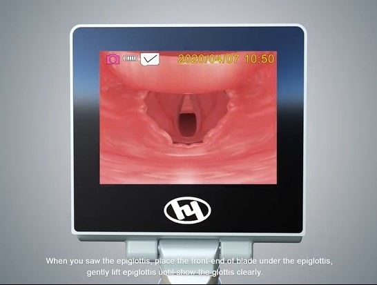 Reusable Anesthesia Video Laryngoscope Airway Intubation With Enhanced View