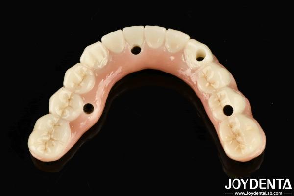 天然の歯と歯歯と互換性のあるチバージルコニアハイブリッドブリッジ 自伝 噛む機能を回復する