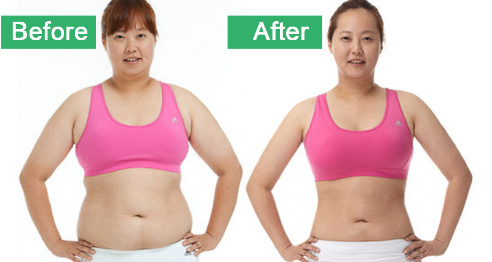 Liposuction Ultrasonic Cavitation Body Slimming Machine For Fat Reduction With RF