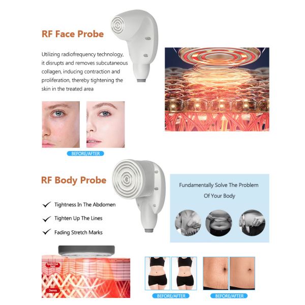 Multifunction 6D 10D Laser Slimming Machine With RF EMS Muscle Stimulation