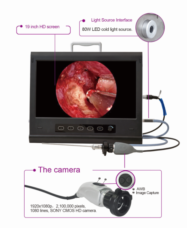 Portable Full HD Endoscope Camera For ENT Laparoscopy Hysteroscopy Cystoscopy Surgery Equipment