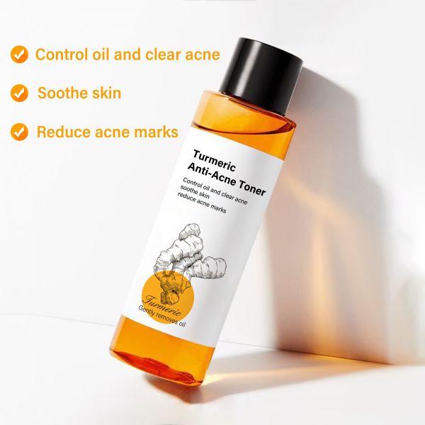 OEM Cúrcuma Anti acné Marcas Tónico de desvanecimiento Hidratante Hidratante Cuidado personal Cuidado facial Cuidado de la piel Tónico de arroz