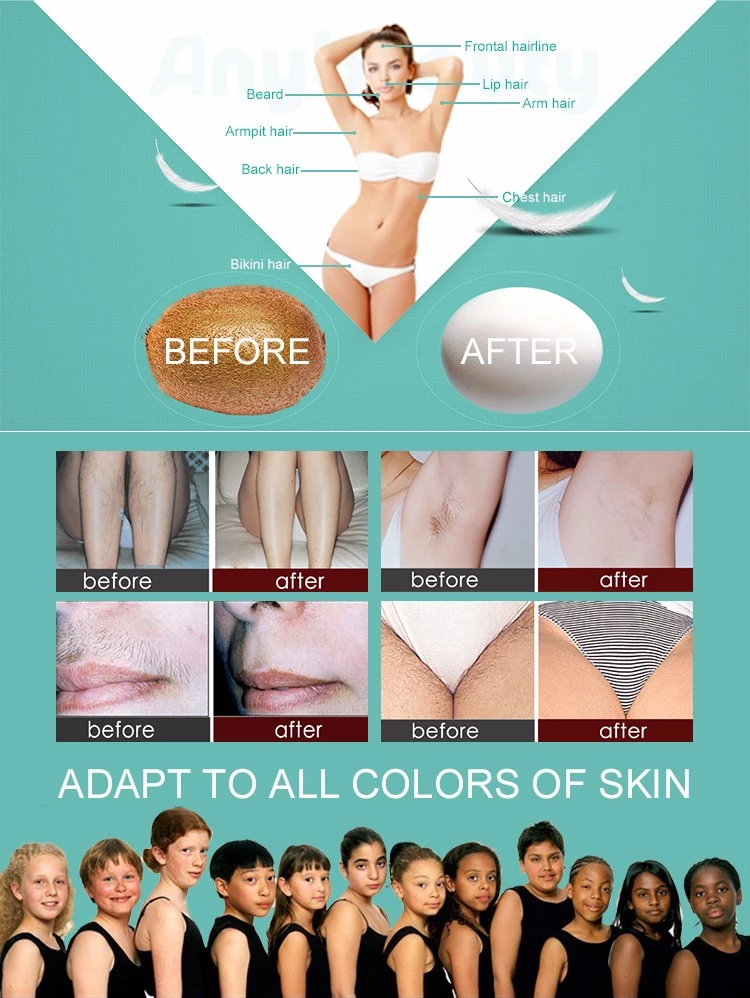 Professional 808nm Diode Laser Hair Removal Machine Vertical CE ISO Certification