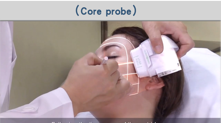 Hifu Treatment For Face Tightening Machine High Intensity Focused Ultrasound Hifu 7D Ultraforma Shurink Technology