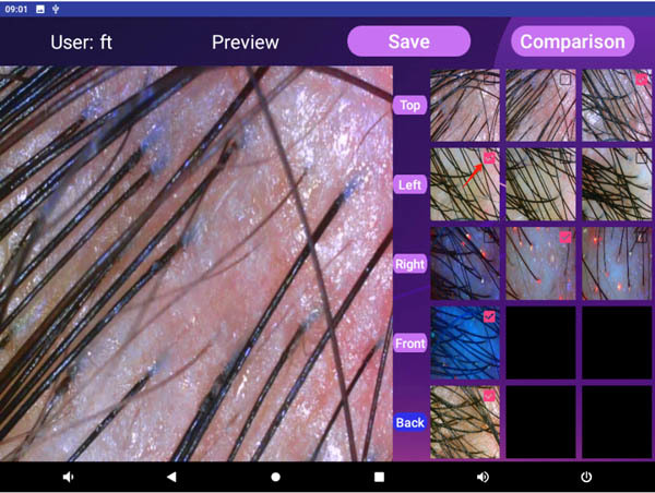 Máquina profesional de escaneo capilar de 50W para análisis capilar para salones/clínicas