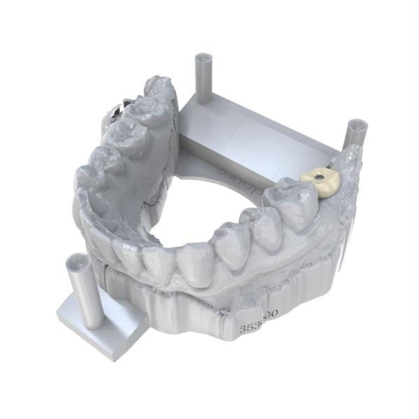 Dental Crown Restoration Permanent Crown Resin For Dental Crowns Volume 1000 Ml