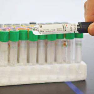 EDTA FNA 血液採取チューブ&血糖値検査&検査遅延シナリオ