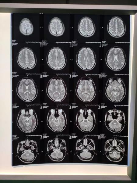 210 Microns Inkjet X Ray Film A3