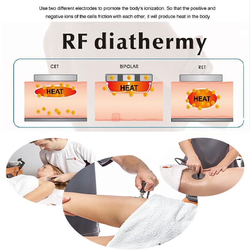 Fat Knife Body Shaping Skin Rejuvenation 220v Rf Beauty Machine RET CET