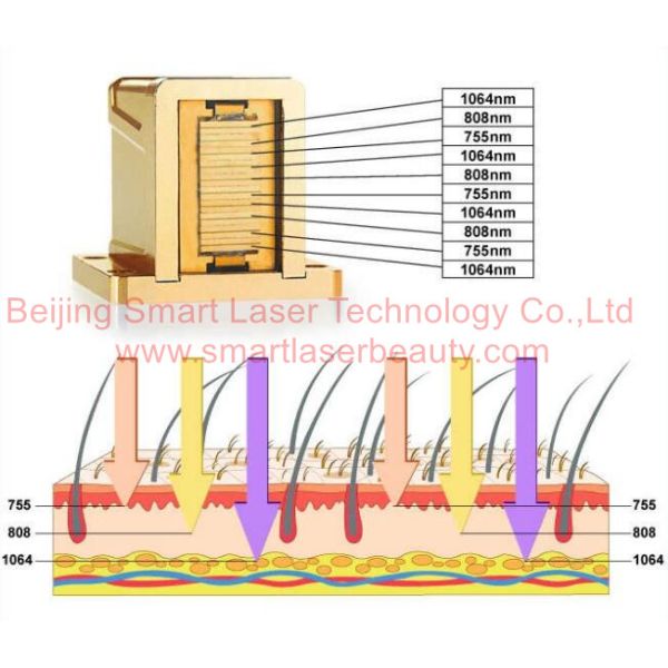 Triple Wavelengths Diode Laser Hair Removal Machine With 755nm, 808nm, 1064nm