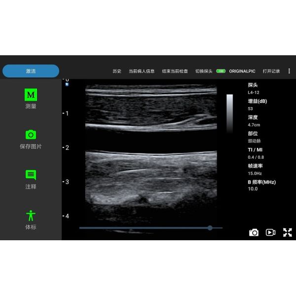 Linear Probe Wireless Ultrasound Machine Portable 4MHz 8.3MHz 12MHz
