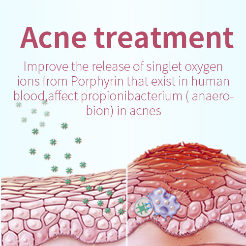 DEESS Ice Cool IPL Hair Removal Machine