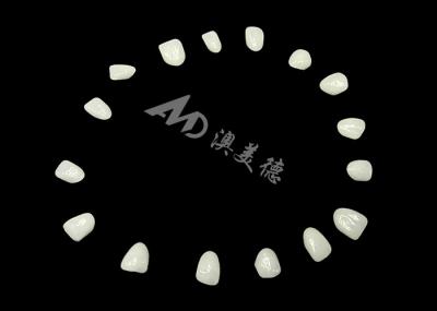 IPS EMAX Porcelain Veneers For Natural Looking Front Teeth Restorations