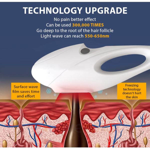 машина 1400W удаления волос 430nm 530nm Elight IPL