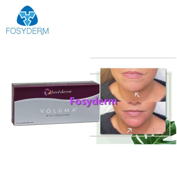 Injeção ácida hialurónica ligada dos enchimentos do bordo de Juvederm 2*1ml cruz cutânea para antienvelhecimento