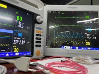 Monitoreo automatizado de signos vitales de múltiples parámetros para ODM de diagnóstico neonatal