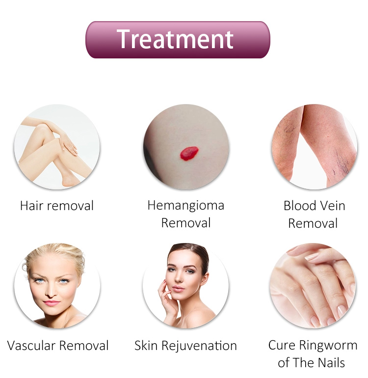 Hair Removal Alexandrite Laser Machine