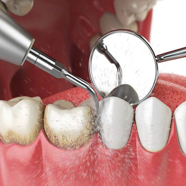 Алюминиевые аппаратуры пересчетки клиники сплава ультра звуковые универсальные