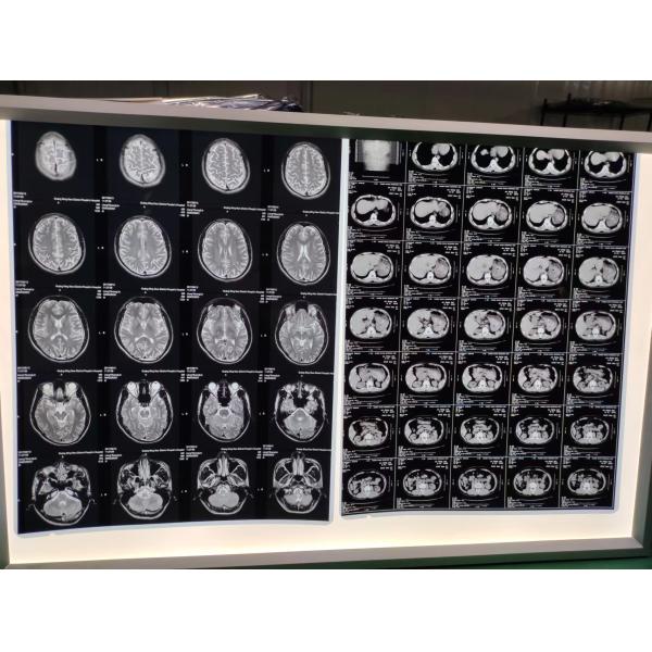 Class I High Max Density Inkjet X Ray Film 8x10 Inch 203mm X 254mm