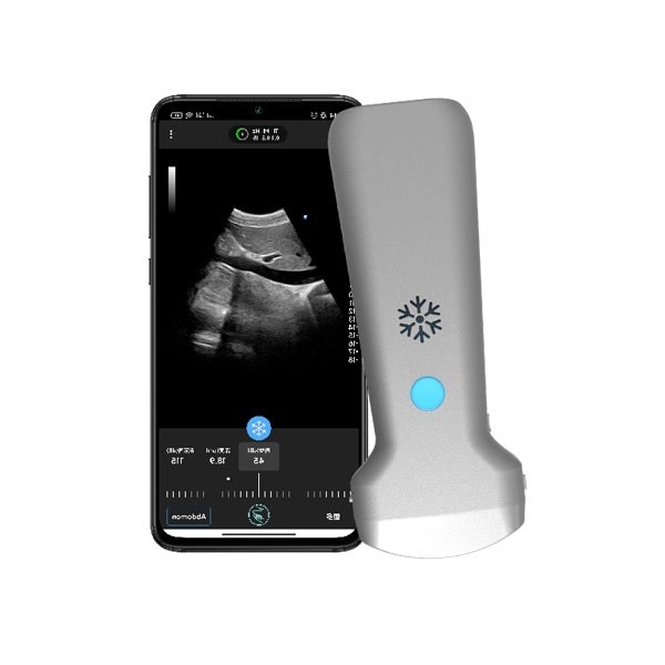 ISO13485 Wireless Convex Handheld Ultrasound Scanner | Portable Color Doppler Ultrasound Probe