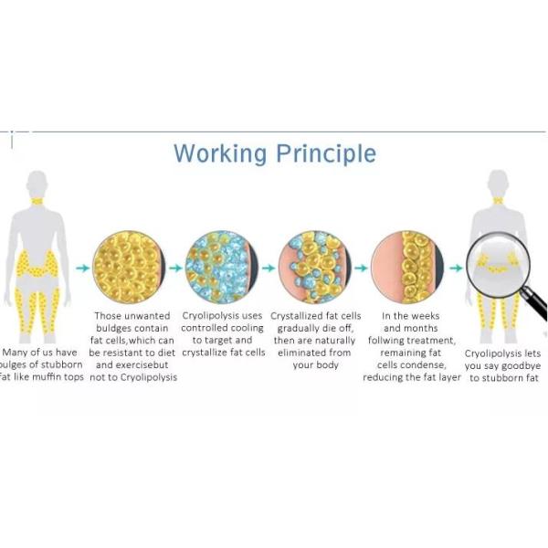 4 Cryo Handles Cryolipolysis Slimming Machine For Body Cellulite Treatment