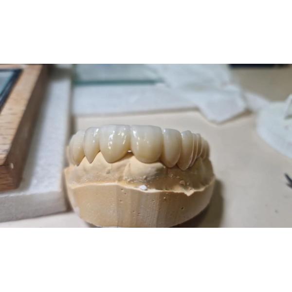 HT Plus Zirconia Block Competent Bridge Restorations For Teeth