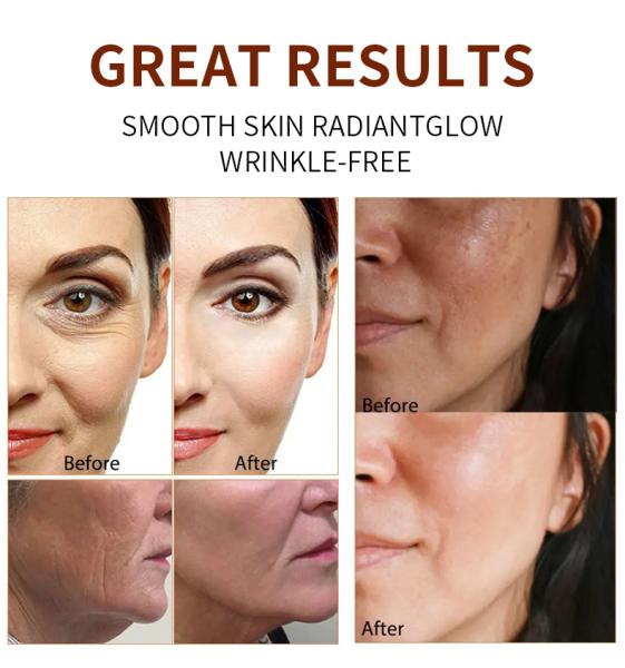 Suero facial para el cuidado de la piel PH5.5 equilibrado, suero de niacinamida para piel sensible, para ojeras e hinchazón