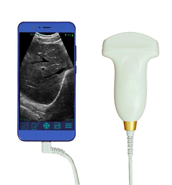 Hot Sale Smart USB Convex Medical Doppler Ultrasound Scanner Ultrasound Probe