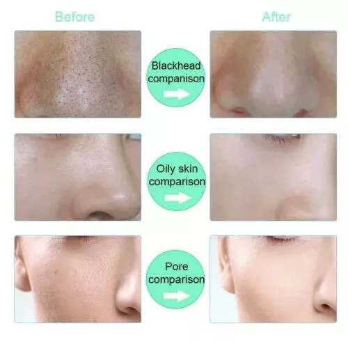 Face Washing Machine Electric Soft Silicone Facial Brush Cleanser Massage