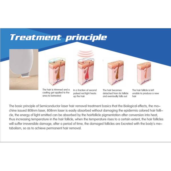 600W strong Power!!! 808nm diode laser hair removal machine /diode laser hair device / diode laser alexandrite