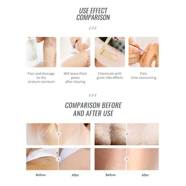2 in 1  Multifunction Beauty Machine DPL laser removal machine laser hair removal painless with Vertical beauty machine