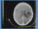 Eco-Friendly Medical Dry Film Agfa 2B X Ray With CT Machine