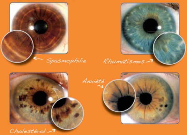 12 MP Iridology Iriscope Iridology Camera
