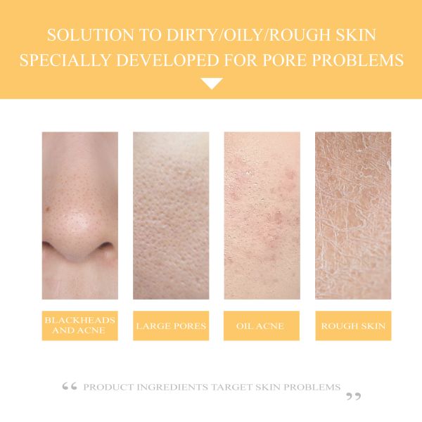 Organic OEM Pores Shrinking Rice Water Toner Facial Hydrating Soothing Moisturizing Skincare Whitening Face Skin Rice Toner