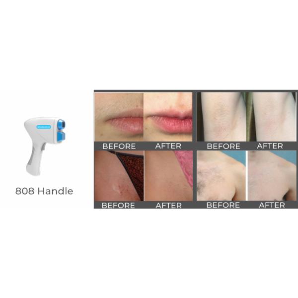 4h Diode Laser Hair Removal Equipment Design Oem Odm