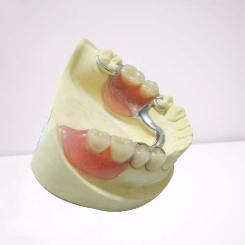 Продукты лаборатории стального съемного частично восстановления Denture Dentures зубоврачебные