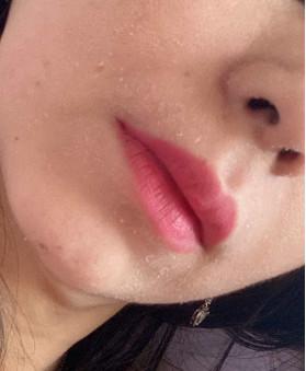 Casca química facial de hidratação ácida Glycolic do tonalizador 100ml Skincare de 10% para iluminar a pele