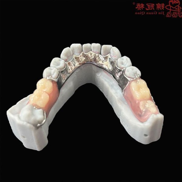 Co Cr Alloy Removable Dentures DSD Aesthetic Design Acrylic Dentures Customized
