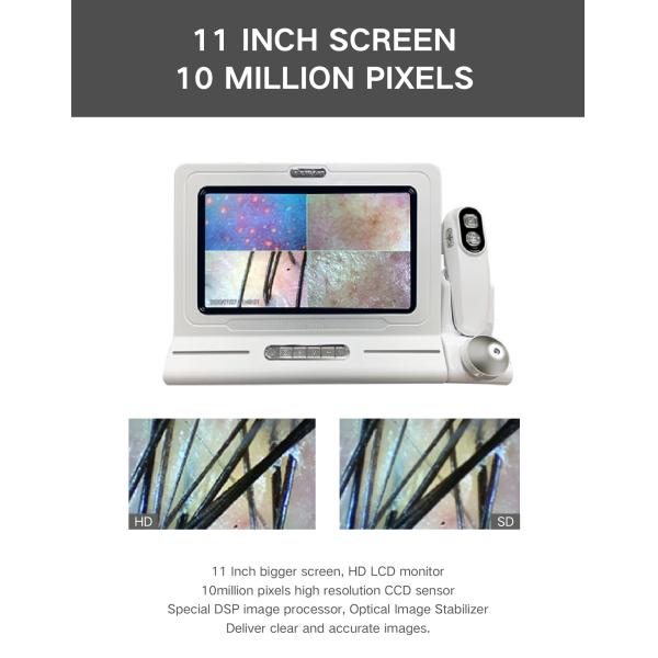 ABS PC 15 Inch HD Screen 200X Camera USB Digital Hair And Skin Analyzer