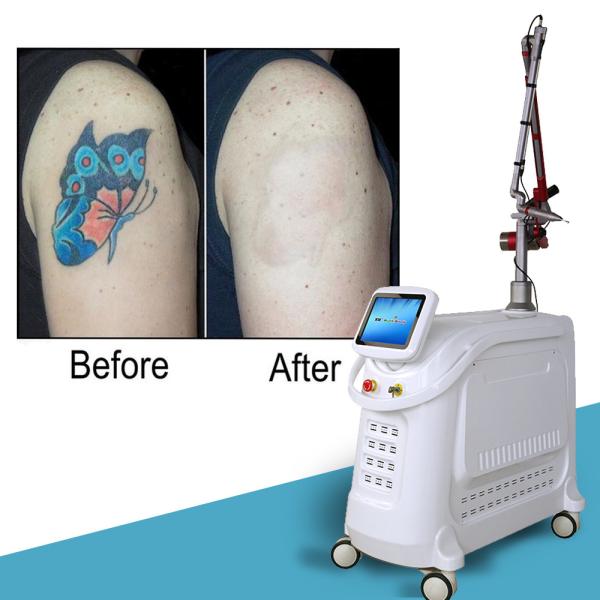 1064nm Q Switched Nd Yag Laser Picosecond Tattoo Removal Machine Stationary Style