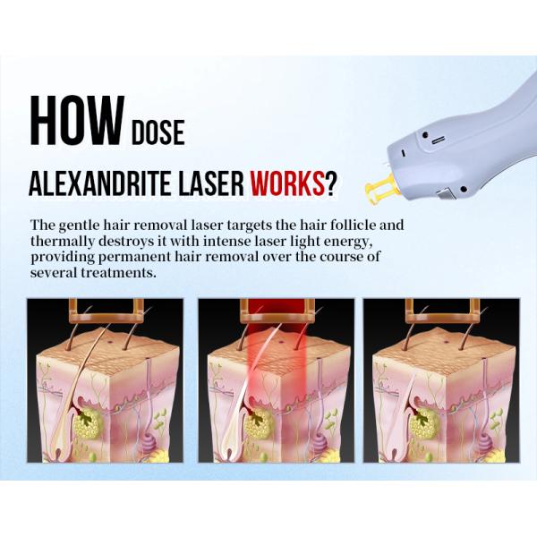 Powerful 1064nm Alexandrite and 755nm Laser Hair Removal Equipment for All Skin Types